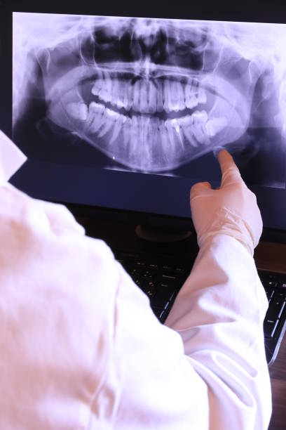 Best Broken or Chipped Tooth Repair in Nicoma Park, OK